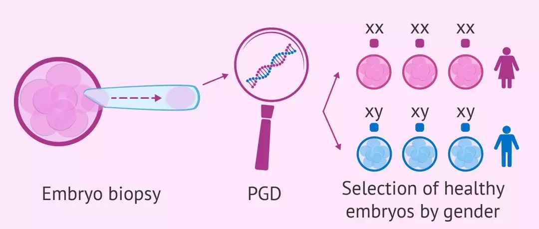 试管婴儿 (IVF)